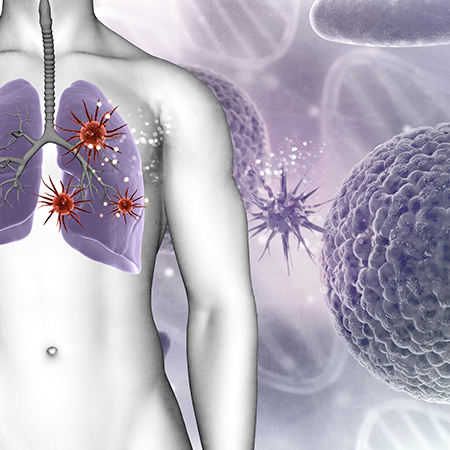 Пневмококковая инфекция